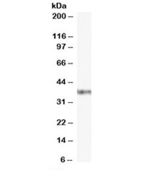 Western blot testing of Jurkat cell lysate with GBX2 antibody at 0.1ug/ml. Predicted molecular weight ~37kDa.~