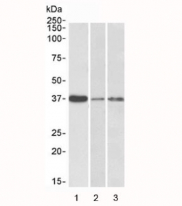 Western blot testing of human 1) liver, 2) skin and 3) tonsil lysate with IL12B antibody at 0.1ug/ml. Predicted molecular weight: 37~40 kDa.