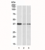 Western blot testing of human 1) liver, 2) skin and 3) tonsil lysate with IL12B antibody at 0.3ug/ml. Predicted molecular weight: 37~40 kDa.