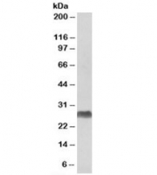 Western blot testing of human bone marrow lysate with HLA-DQA2 antibody at 1ug/ml. Predicted molecular weight: ~28kDa.