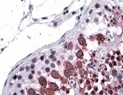 IHC staining of FFPE human testis with GALR3 antibody at 3.8ug/ml. HIER: steamed with pH6 citrate buffer, AP-staining.