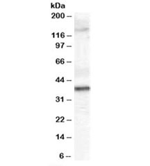Western blot testing of human skin lysate with GALR3 antibody at 2ug/ml. Predicted molecular weight ~39kDa.~
