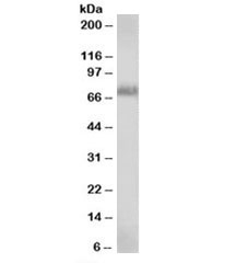 Western blot testing of A431cell lysate with RAD9A antibody at 0.3ug/ml. Predicted molecular weight: ~45/70kDa (unmodified/modified). (Ref 1)~