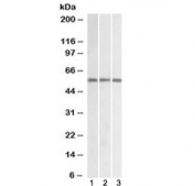Western blot testing of 1) A549, 2) human spleen and 3) human PBL lysate with IRF5 antibody at 1ug/ml. Predicted molecular weight ~57 kDa.