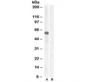 Western blot of HEK293 lysate overexpressing human IRF5 and probed with IRF5 antibody at 1ug/ml (mock transfection in lane B). Predicted molecular weight ~55kDa.