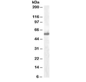 Western blot testing of A549 lysate with IRF5 antibody at 0.1ug/ml. Predicted molecular weight ~57kDa.~