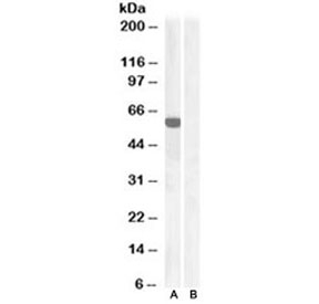 Western blot of HEK293 lysate overexpressing human IRF5 and probed with IRF5 antibody at 1ug/ml (mock transfection in lane B). Pred