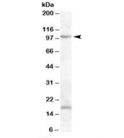 Western blot testing of human lung lysate with MARCH6 antibody at 0.2ug/ml. Both the ~100kDa specific band and additional ~18kDa band block with immunizing peptide.