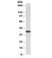 Western blot testing of KELLY cell lysate with MSI2 antibody at 2ug/ml. Predicted molecular weight: ~35kDa.