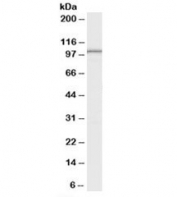 Western blot testing of human testis lysate with LARP2 antibody at 0.1ug/ml. Predicted molecular weight: ~105kDa.