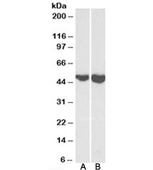 Western blot testing of mouse brain (A) and heart (B) lysates with GOT2 antibody at 0.1ug/ml. Predicted molecular weight ~47kDa.