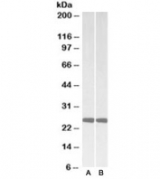 Western blot of mouse (A) and rat (B) brain lysates with PGP9.5 antibody at 0.01ug/ml. Predicted molecular weight ~25kDa.