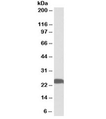 Western blot testing of human hippocampus lysate with PGP9.5 antibody at 0.01ug/ml. Predicted molecular weight ~25kDa.~