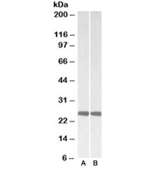 Western blot of mouse (A) and rat (B) brain lysates with PGP9.5 antibody at 0.01ug/ml. Predicted molecular weight ~