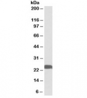 Western blot testing of human hippocampus lysate with PGP9.5 antibody at 0.01ug/ml. Predicted molecular weight ~25kDa.