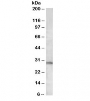 Western blot testing of human skeletal muscle lysate with RSPO3 antibody at 0.3ug/ml. Predicted molecular weight ~30kDa.