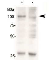 Western blot of 143B cells overexpressing human AARS2 tested with AARS2 antibody (mock transfection in lane 2). Predicted molecular weight: ~107kDa.