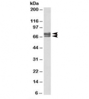 Western blot testing of human kidney lysate with PEX5 antibody at 0.1ug/ml. In this test, isoform a (654 AA) and isoform c (602 AA) are detected.
