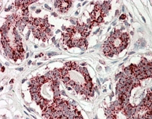 IHC staining of FFPE human breast with Aconitase 3 antibody at 3.8ug/ml. HIER: steamed with pH6 citrate buffer, AP-staini