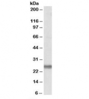 Western blot testing of human placenta lysate with SNAP23 antibody at 0.1ug/ml. Expected molecular weight: ~23/18kDa (isoforms 1/2).