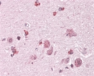 IHC testing of FFPE human cortex with Chimaerin 2 antibody at 4ug/ml. HIER: steamed with pH6 citrate buffer, AP-staining.