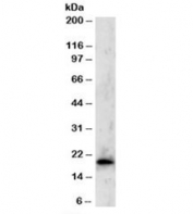 Western blot testing of Jurkat lysate with TBPL1 antibody at 2ug/ml. Predicted molecular weight: ~20kDa.