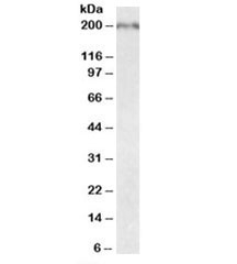 Western blot testing of fetal mouse brain lysate with Robo1 antibody at 0.05ug/ml. Predicted molecular weight (mouse): ~176kDa.