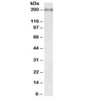 Western blot testing of fetal mouse brain lysate with Robo1 antibody at 0.05ug/ml. Predicted molecular weight (mouse): ~176kDa but may be observed at higher molecular weights due to glycosylation.