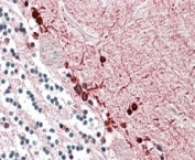 IHC staining of FFPE human cerebellum with ALDH9A1 antibody at 3.8ug/ml. HIER: steamed with pH6 citrate buffer, AP-staining.