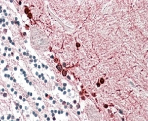 IHC staining of FFPE human cerebellum with ALDH9A1 antibody at 3.8ug/ml. HIER: steamed