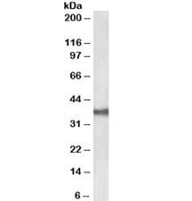 Western blot testing of CACO-2 lysate with EpCAM antibody at 0.03ug/ml. Predicted molecular weight ~35kDa.