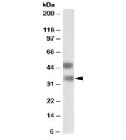 Western blot testing of human spleen lysate with GEM antibody at 1ug/ml. Spleen lysate shows a similar band pattern as transfected cell lysate. Predicted molecular weight ~34kDa.