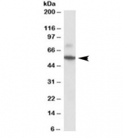 Western blot testing of rat colon lysate with Peripherin antibody at 0.1ug/ml. Expected molecular weight ~55kDa. Both bands are blocked by the immunizing peptide.