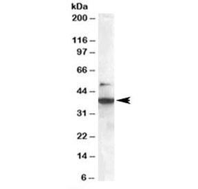 Western blot testing of Jurkat lysate with SH3GLB1 antibody at 0.3ug/ml. The expected ~38kDa and additional ~50kDa band are both blocked by the immunizing peptide.~
