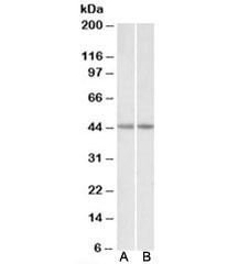 Western blot testing of human [A] and mouse [B] heart lysates with CKM antibody at 0.03ug/ml. Predicted molecular weight: ~43kDa.~
