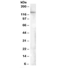 Western blot testing of human adipose lysate with FAM62A antibody at 0.5ug/ml. Predicted molecular weight: ~123kDa, observed here at ~150kDa.