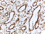 IHC testing of FFPE human kidney with ILF3 antibody at 2ug/ml. HIER: steamed with pH6 citrate buffer, HRP-staining.