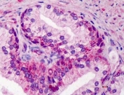 IHC testing of FFPE human prostate tissue with GDF15 antibody at 5ug/ml. Required HIER: steamed antigen retrieval with pH6 citrate buffer; AP-staining.