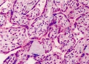 IHC testing of FFPE human placenta tissue with GDF15 antibody at 5ug/ml. Required HIER: steamed antigen retrieval with pH6 citrate buffer; AP-staining.