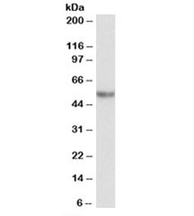 Western blot testing of albumin-depleted human plasma lysate with SERPINA1 antibody at 0.3ug/ml. Predicted molecular weight: ~47/52kDa (unmodified/glycosylated).