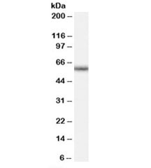 Western blot testing of human peripheral blood mononucleocyte lysate with GNRHR antibody at 0.5ug/ml. Predicted molecular weight ~38/60kDa (unmodified/glycosylated).