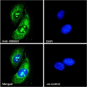 Immunofluorescent staining of human U-2 OS cells with RBM20 antibody (green) at 10ug/ml and DAPI nuclear stain (blue).