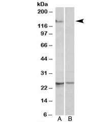 Western blot testing of mouse heart lysate with RBM20 antibody at 1ug/ml with [B] and without [A] blocking/immunizing peptide. Predicted molecular weight (mouse): ~130kDa, observed here at ~150kDa.~
