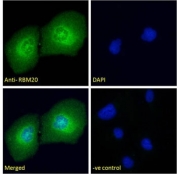 Immunofluorescent staining of human U-2 OS cells with RBM20 antibody (green) at 10ug/ml and DAPI nuclear stain (blue).