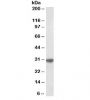 Western blot testing of human peripheral blood lymphocyte lysate with IL-1 beta antibody at 1ug/ml. Predicted molecular weight ~31kDa.