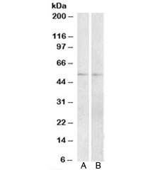 Western blot testing of A) mouse and B) rat small intestine lysate with Vipr1 antibody at 2ug/ml. Predicted/observed molecular weight: ~52kDa.