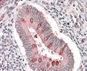 IHC staining of FFPE human uterus with TSC1 antibody at 3.8ug/ml. HIER: steamed with pH6 citrate buffer, AP-staining.