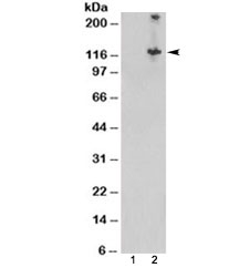 Western blot of HEK293 lysate overexpressing human TSC1 probed with TSC1 antibody (mock transfection in lane 1). Expected/observed molecular weight: 130~150/120kDa.