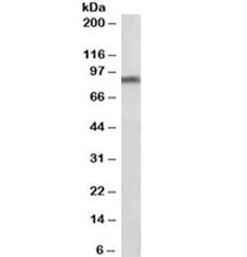 Western blot testing of human substantia nigra lysate with DAT antibody at 1ug/ml. Predicted molecular weight ~50kDa (non-glycosylated) and ~80kDa (glycosylated).