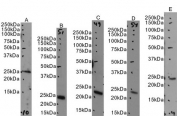 Western blot testing of human A) A431 nuclear fraction, B) HEK293 nuclear fraction, C) HeLa nuclear fraction, D) Jurkat nuclear fraction and E) HepG2 nuclear fraction lysate with UBE2T antibody. Predicted molecular weight: ~22 kDa.